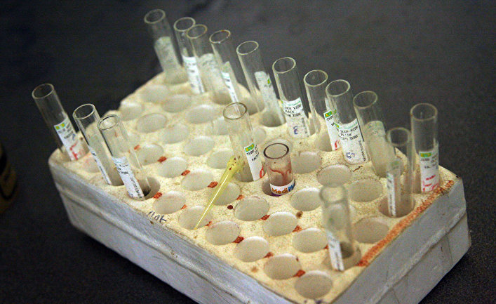 Образцы крови, приготовленные к анализу на ВИЧ