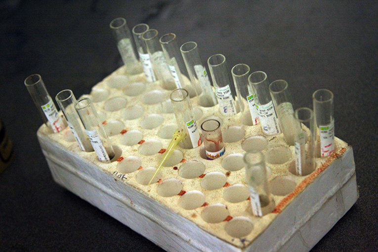 Образцы крови, приготовленные к анализу на ВИЧ