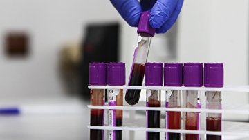 Пробирки с образцами крови для исследований в онкологическом диспансере