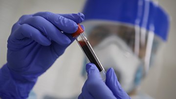 Тестирование на антитела к коронавирусу