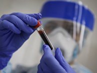 Тестирование на антитела к коронавирусу Тестирование на антитела к коронавирусу