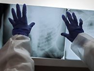Медик смотрит рентгеновский снимок легких пациента