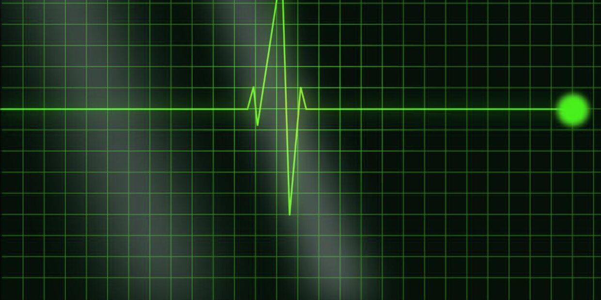 Частота сердцебиения влияет на продолжительность жизни?  После изучения двух миллионов записей был найден идеальный пульс