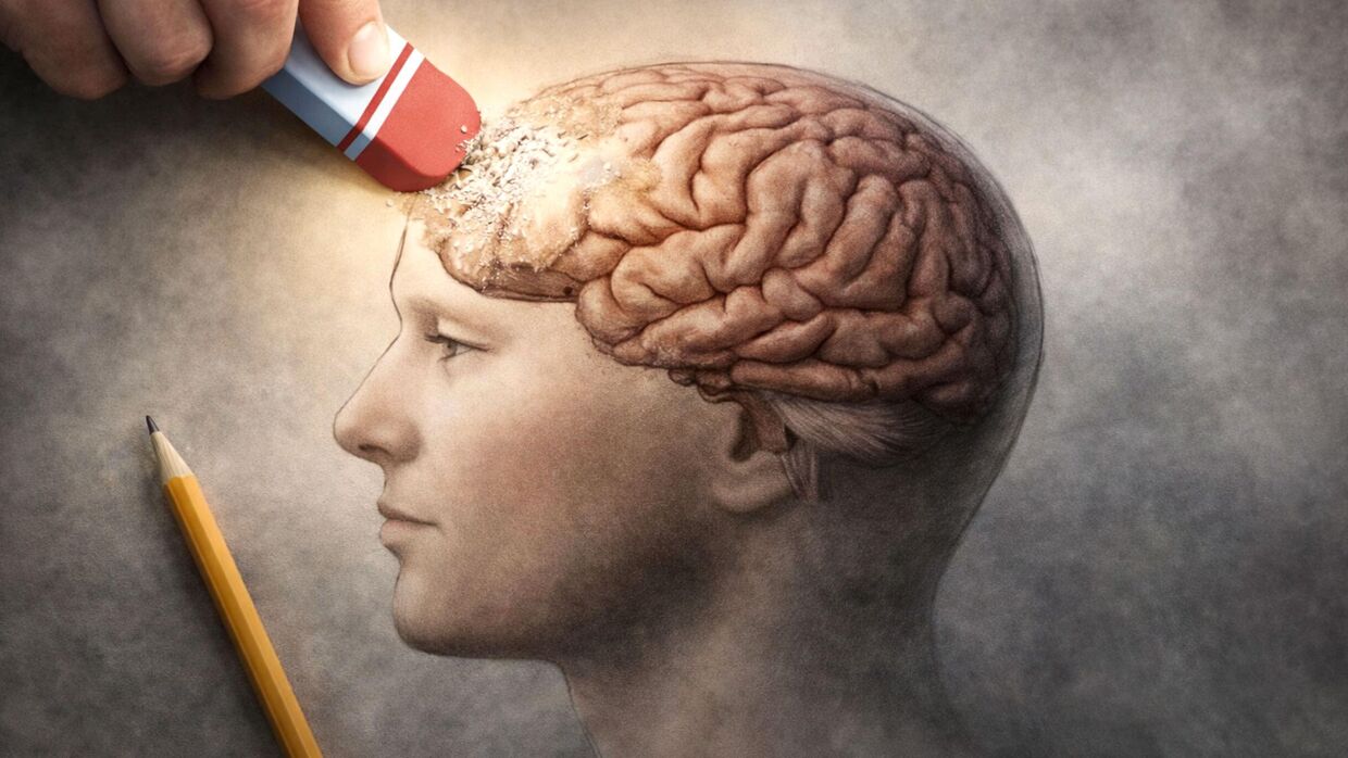 Болезнь Альцгеймера