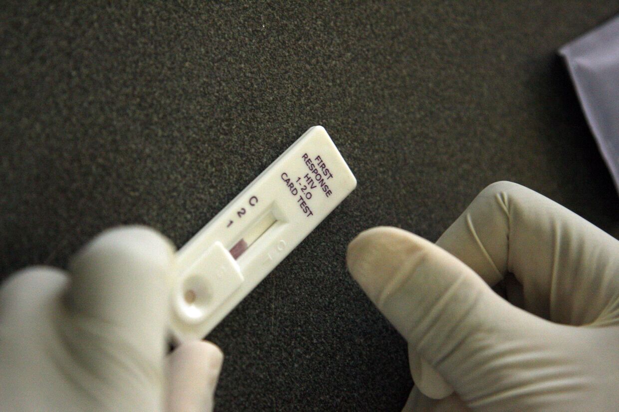 Экспресс-тестирование крови на наличие ВИЧ