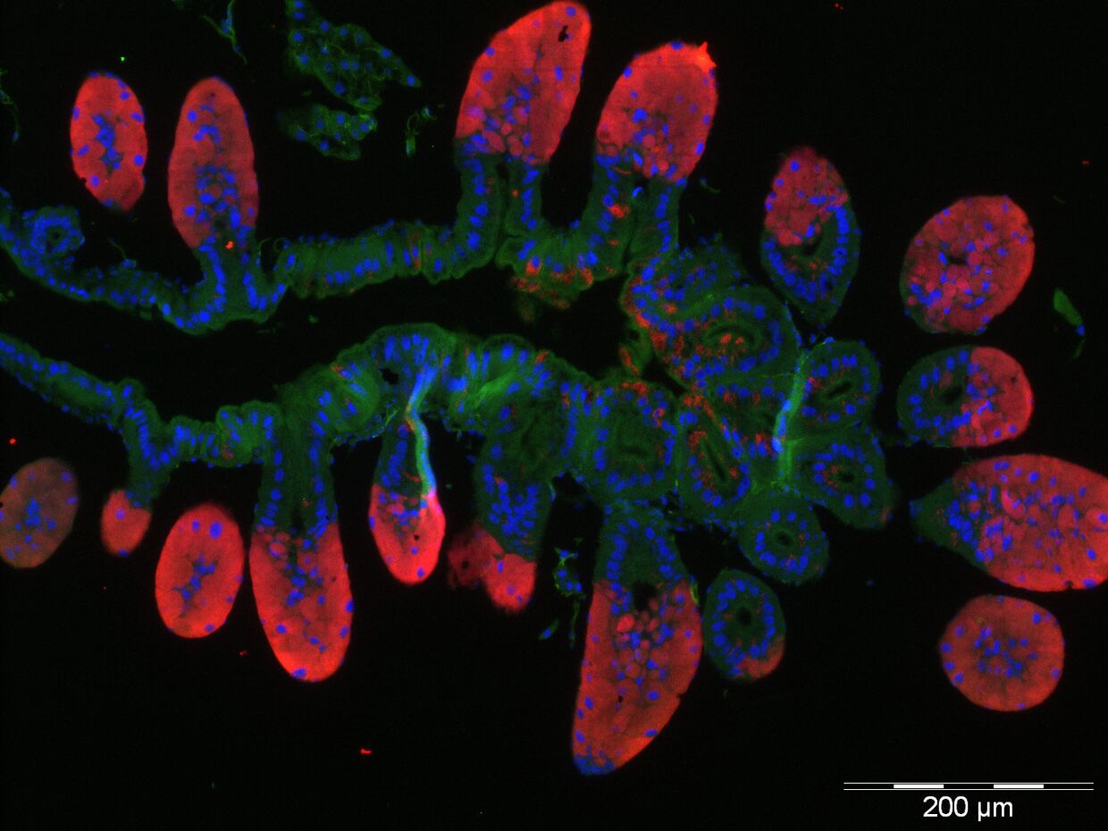 Клетки кишечника долгоносика, окруженные бактериями-симбионтами