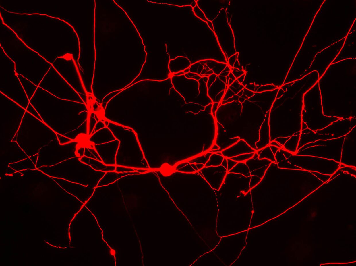 Нейроны, созданные из клеток кожи мышей с помощью воздействия генов