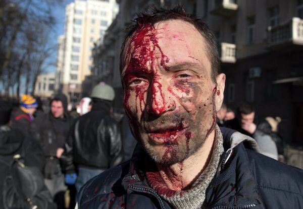 Пострадавший полицейский в ходе беспорядков в Киеве