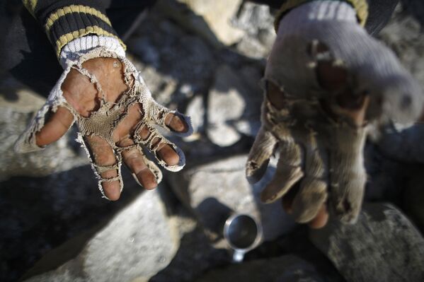 Резчик по камню, работающий на строительстве отеля в Намче, показывает свои истертые перчатки