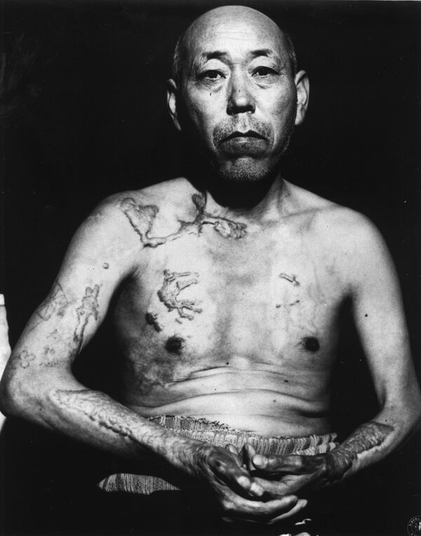 Дзинпе Теравама, переживший атомную бомбардировку Хиросимы
