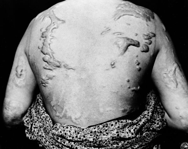 Икими Киккава, пережившая атомную бомбардировку Хиросимы