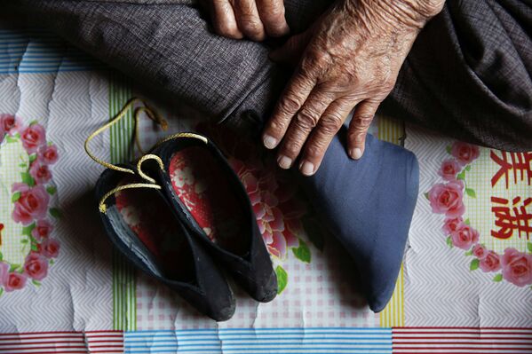 Ноги Чжан Сяньту, бывшей «женщины для утешения»