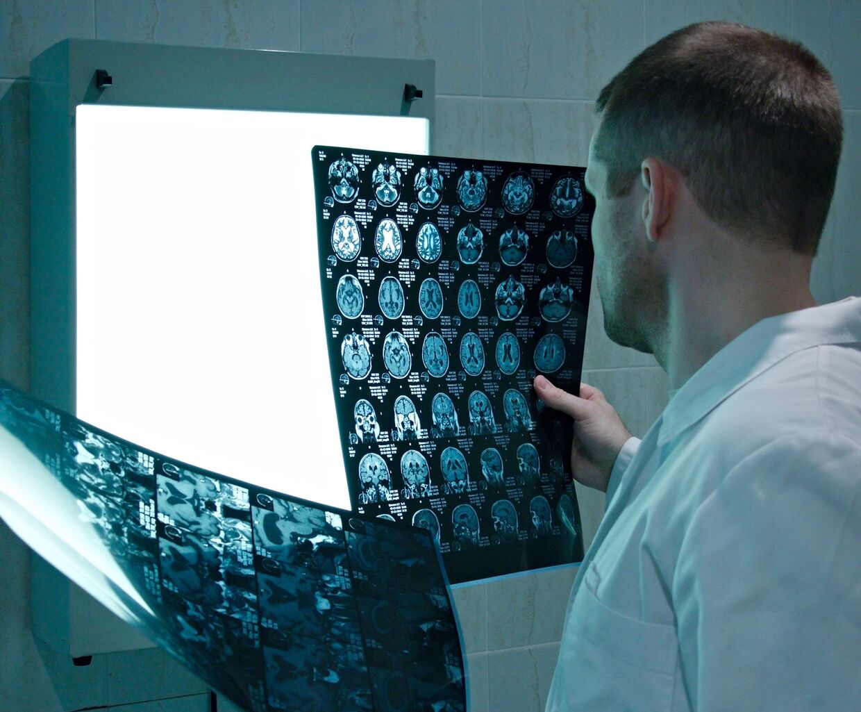 Доктор изучает рентгеновские снимки мозга