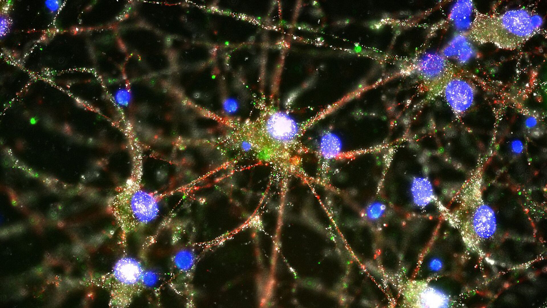 Нейроны мозга - ИноСМИ, 1920, 05.08.2023