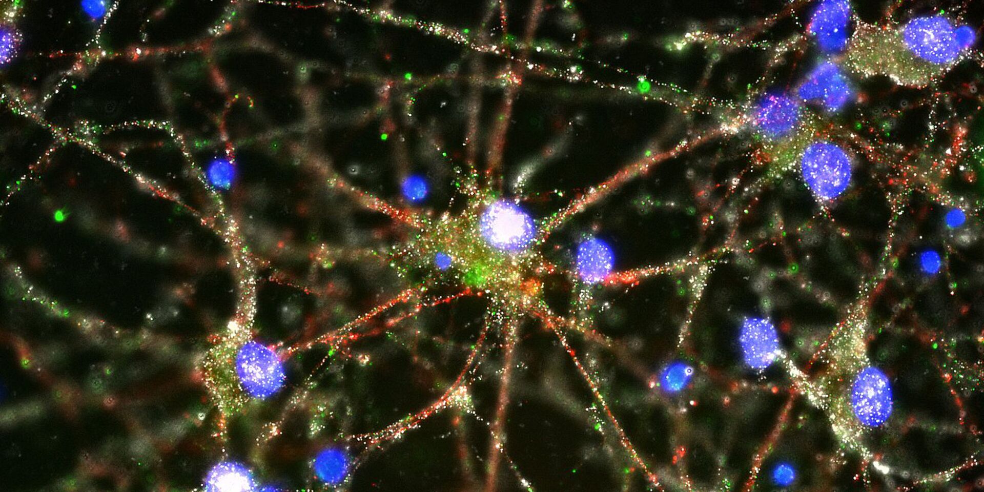 Нейроны мозга - ИноСМИ, 1920, 09.07.2023