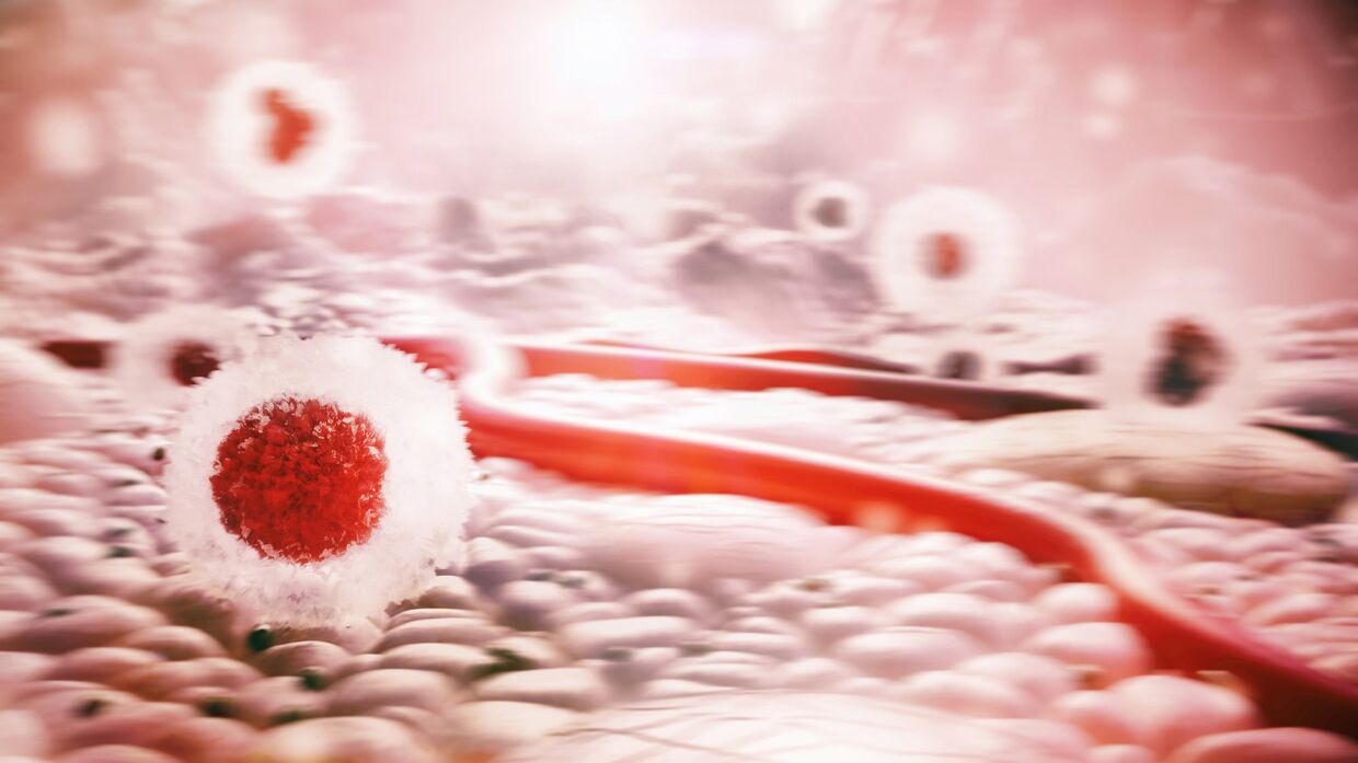 Клетки рака в организме человека