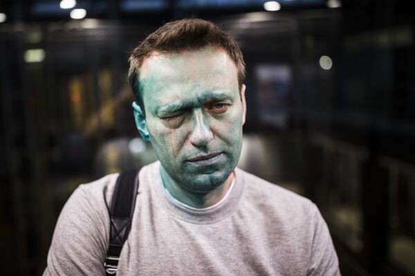 Российский оппозиционер Алексей Навальный после нападения на него неизвестных злоумышленников Российский оппозиционер Алексей Навальный после нападения на него неизвестных злоумышленников