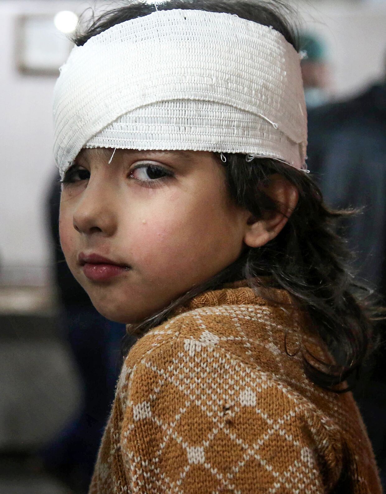 Раненая сирийская девочка после бомбардировок в Восточной Гуте