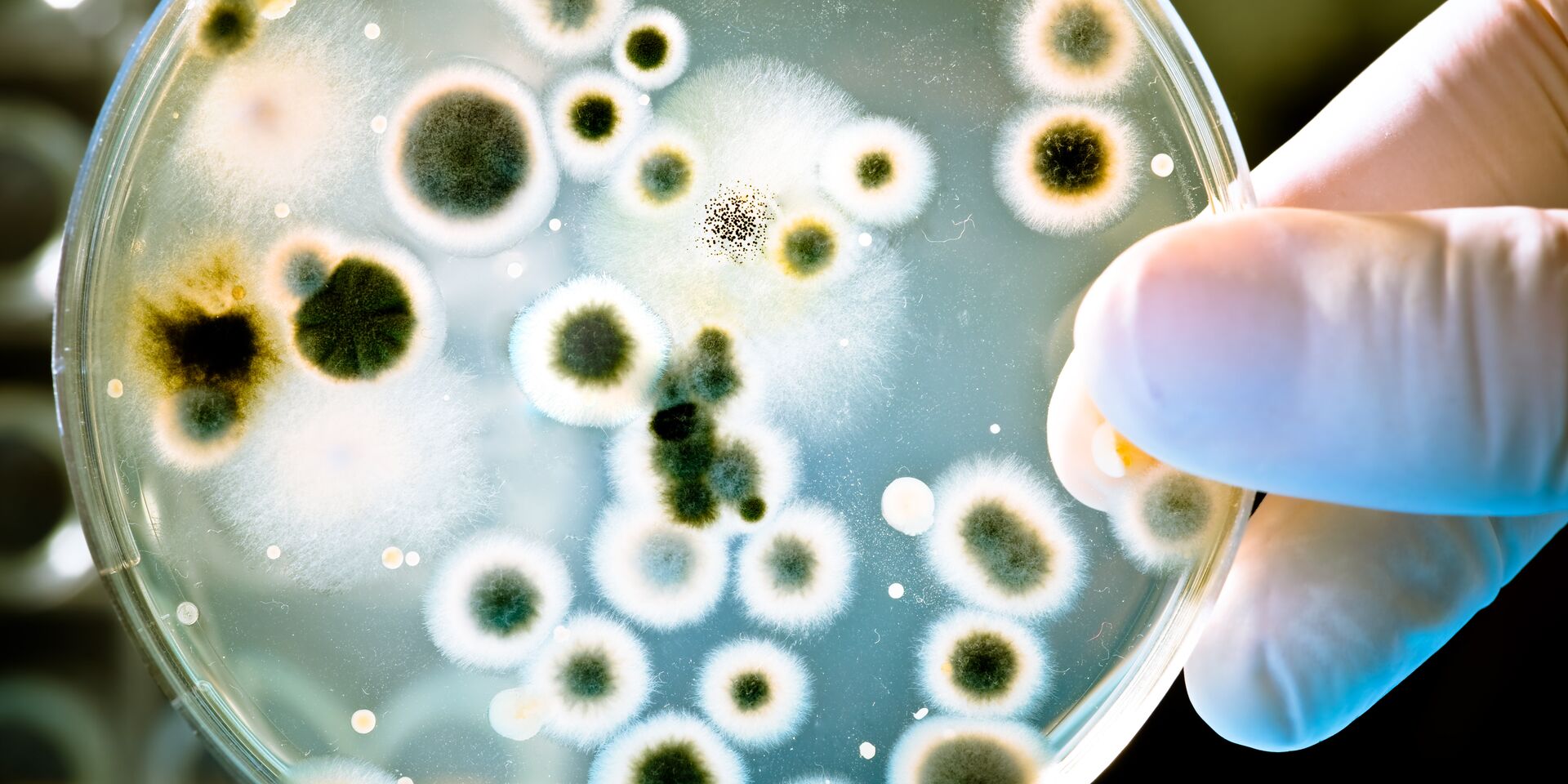 Бактерии - ИноСМИ, 1920, 17.07.2021
