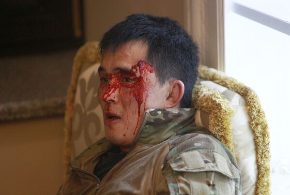 Сотрудник государственных сил безопасности Кыргызстана, получивший ранение во время операции по задержанию Алмазбека Атамбаева