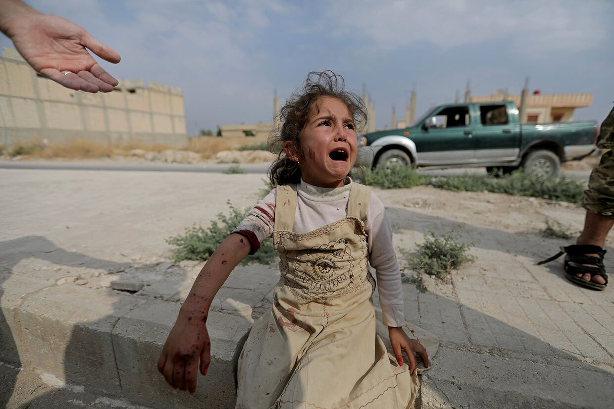 Раненая девочка в городе Таль-Абьяд, Сирия