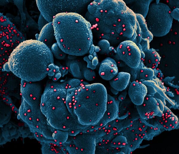 Коронавирус (окрашен красным) атакует клетки в организме заболевшего