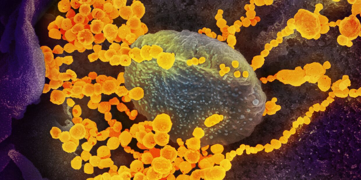 SARS-CoV-2 (окрашен желтым) атакует клетки, культивируемые в лаборатории