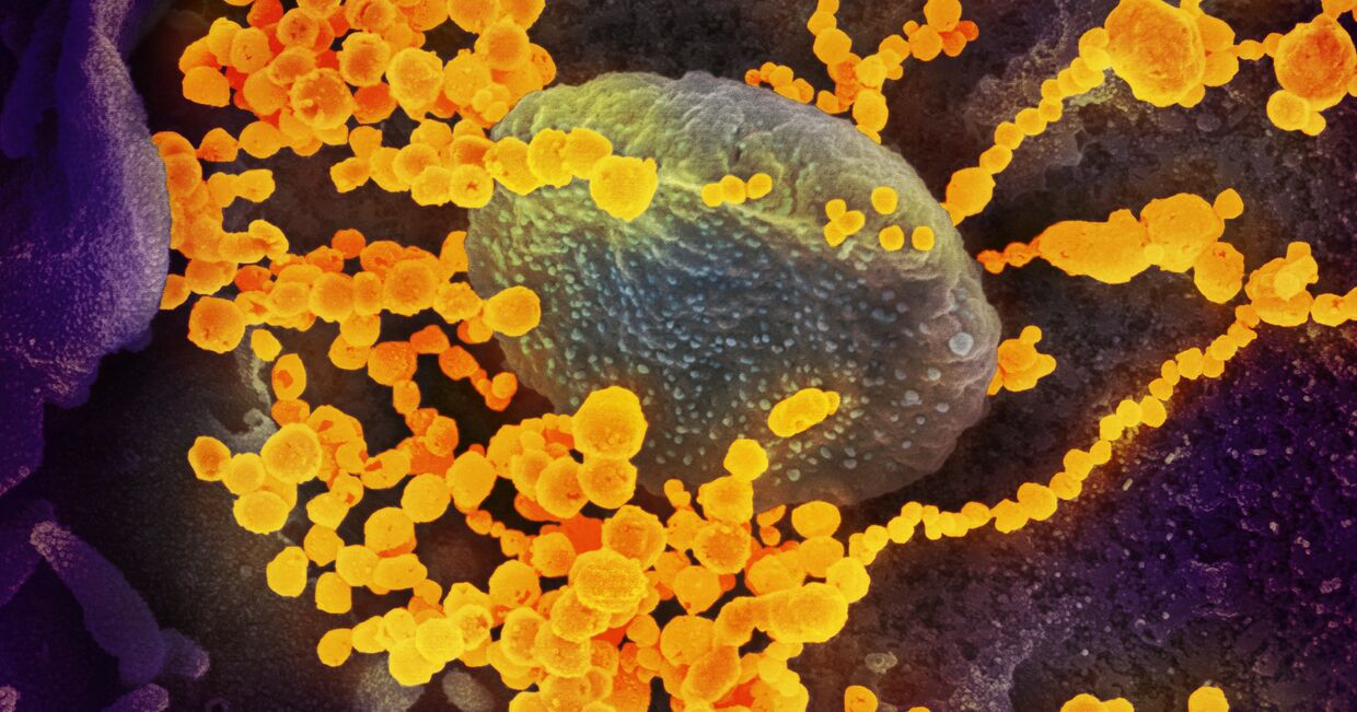 SARS-CoV-2 (окрашен желтым) атакует клетки, культивируемые в лаборатории