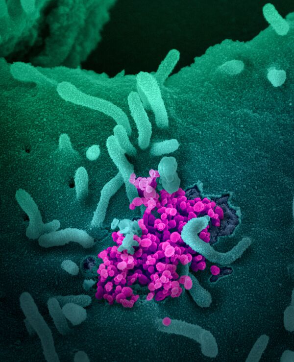 SARS-CoV-2 (окрашен фиолетовым) атакует клетки, культивируемые в лаборатории