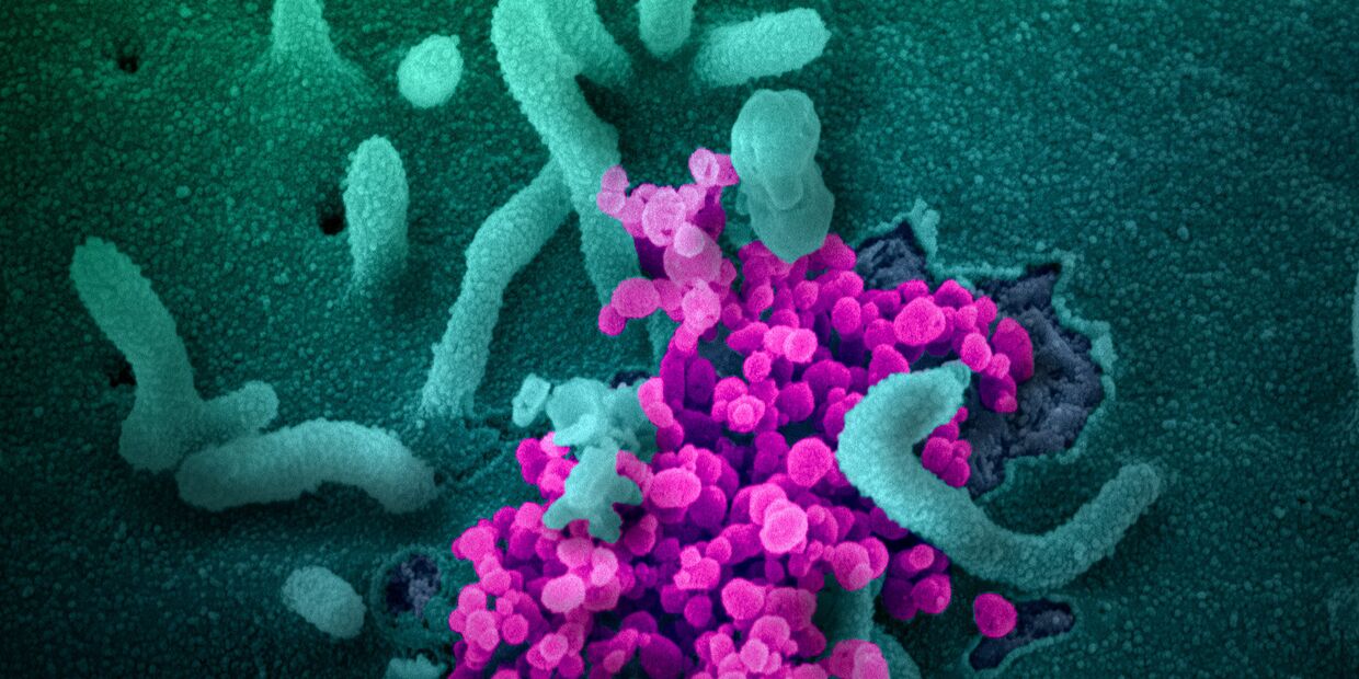SARS-CoV-2 (окрашен фиолетовым) атакует клетки, культивируемые в лаборатории