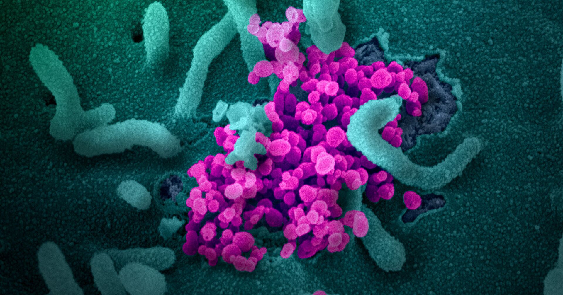 SARS-CoV-2 (окрашен фиолетовым) атакует клетки, культивируемые в лаборатории - ИноСМИ, 1920, 01.09.2021