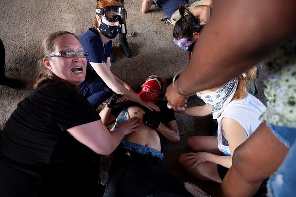 Демонстрант, раненный полицией в Остине