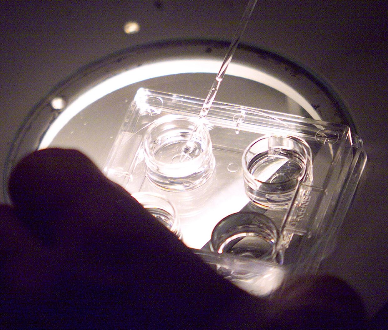 Подготовка яйцеклеток в Центре изучения и сохранения спермы человека в Ренне, Франция