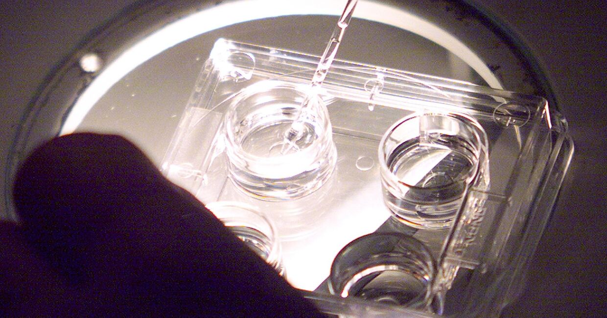 Подготовка яйцеклеток в Центре изучения и сохранения спермы человека в Ренне, Франция