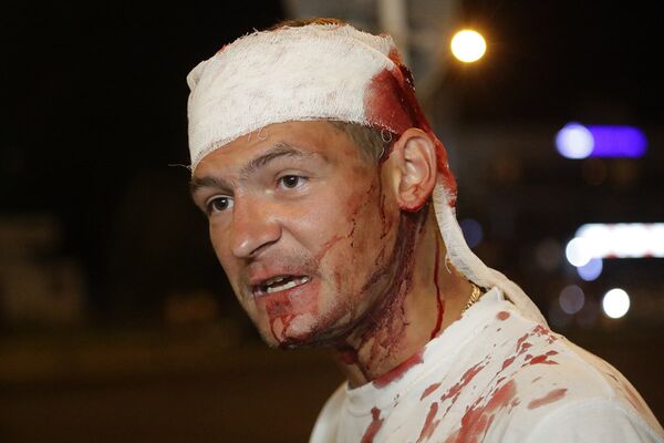 Мужчина, раненный во время столкновений с милицией в Минске, Беларусь