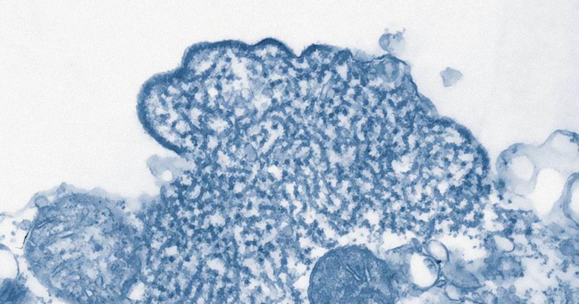 Вирус Нипах, обнаруженный в спинномозговой жидкости пациента - ИноСМИ, 1920, 05.02.2021