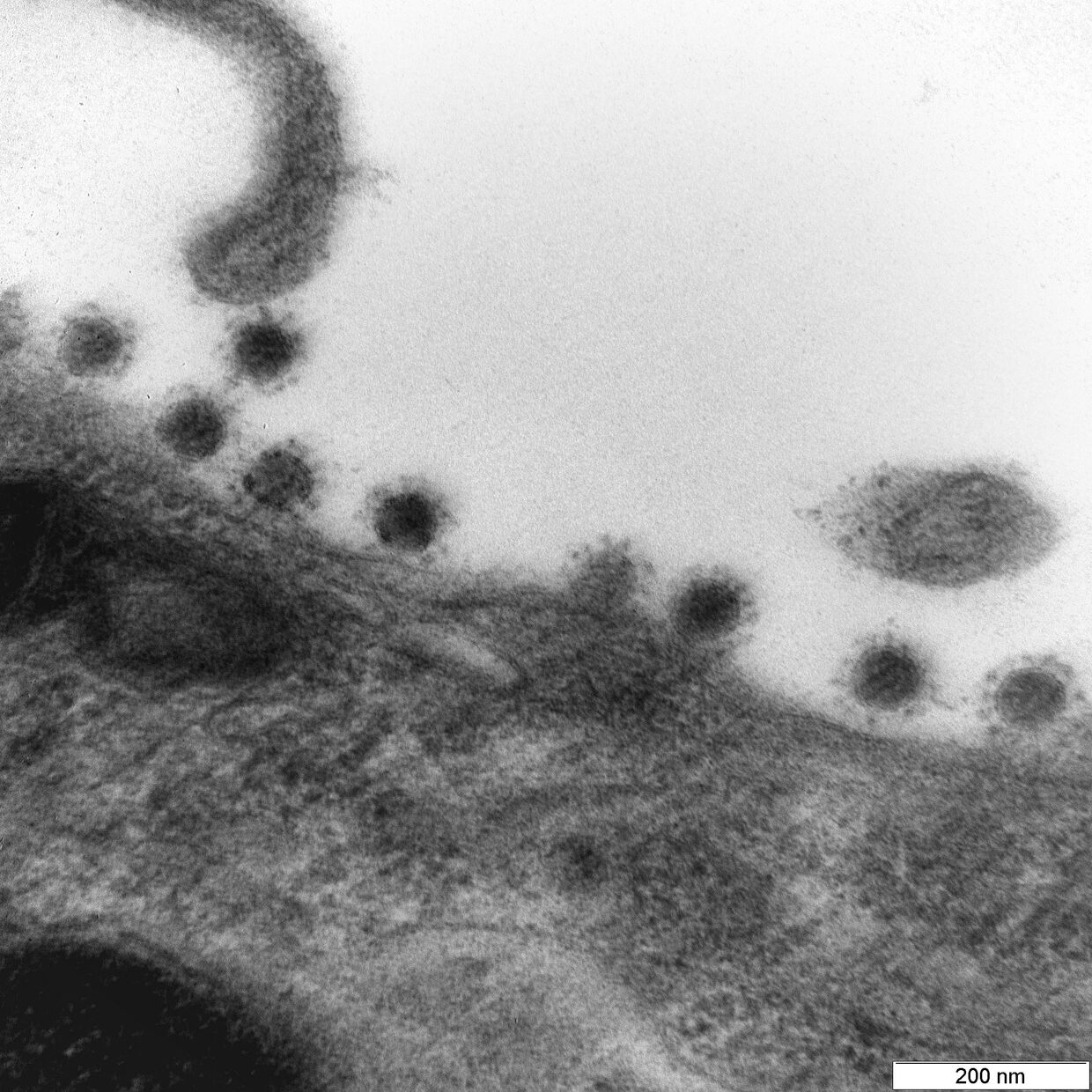 Центр Вектор опубликовал фото дельта-штамма коронавируса